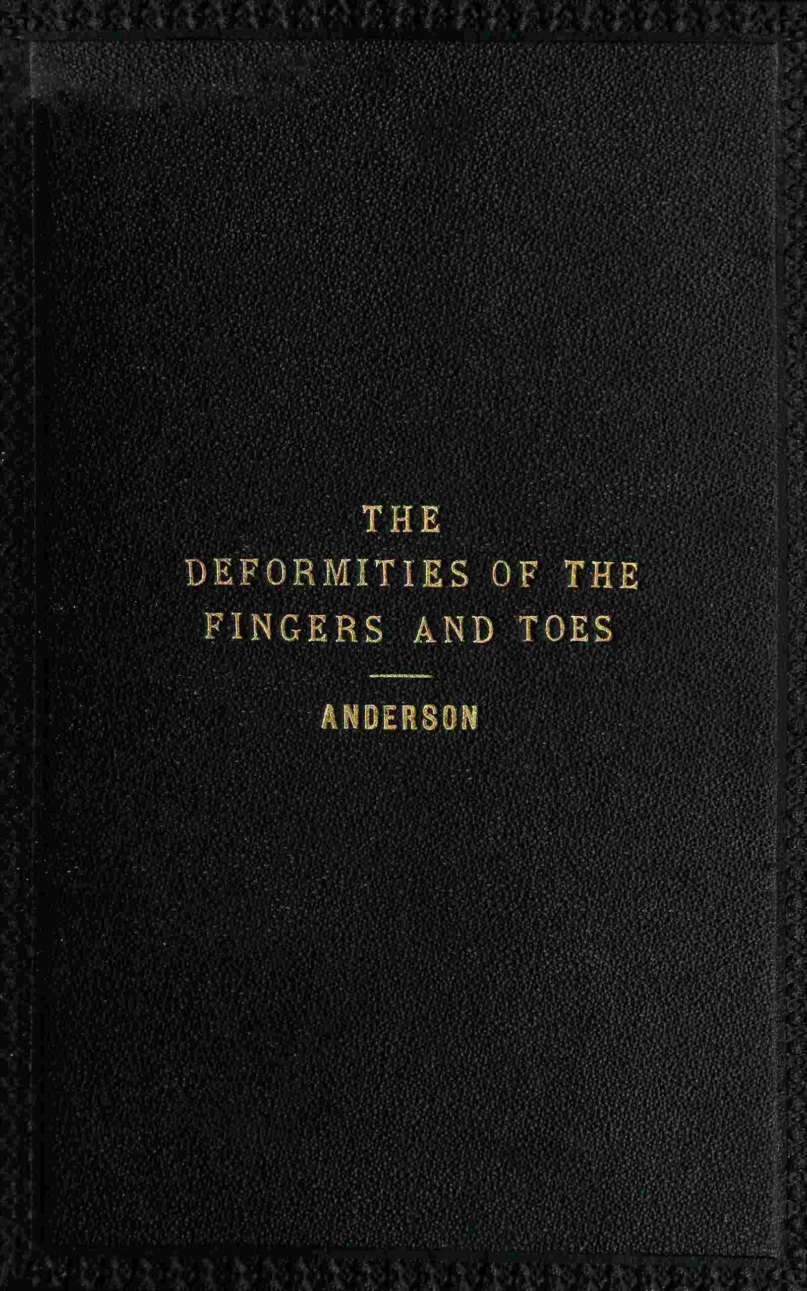 The Deformities of the Fingers and Toes